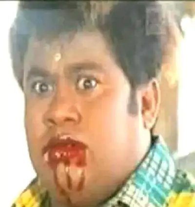 Senthil bleeding mouth